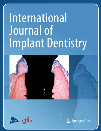 International Journal of Implant Dentistry